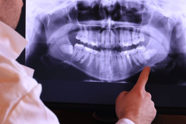 Best Broken or Cracked Tooth Emergency Dentist in Wallingford Center, CT