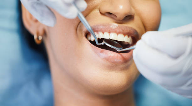 Best Emergency Dental Extractions in Wallingford Center, CT