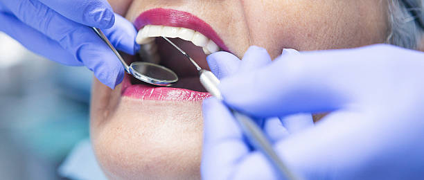 Best Emergency Dental Care for Abscessed Tooth in Wallingford Center, CT